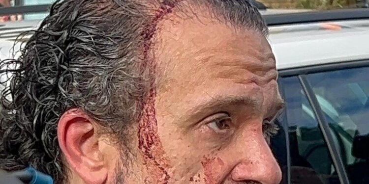 Modena, il racconto di Luca Signorelli: ‘Mi sono arrivati due fendenti, così l’ho neutralizzato’